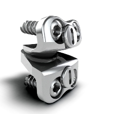 Cervical Disc Arthroplasty